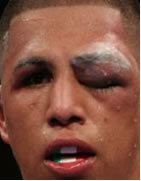 Fernando Vargas